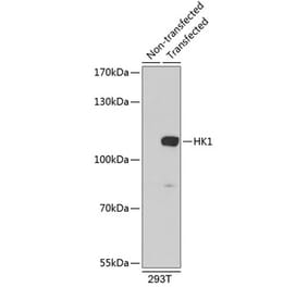 Western Blot - Anti-Hexokinase 1 Antibody (A8428) - Antibodies.com