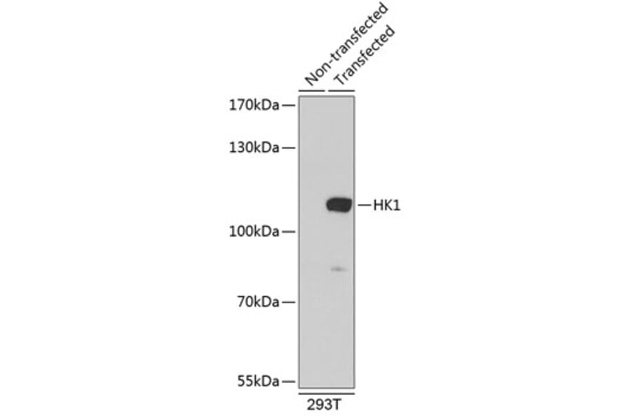 Western Blot - Anti-Hexokinase 1 Antibody (A8428) - Antibodies.com