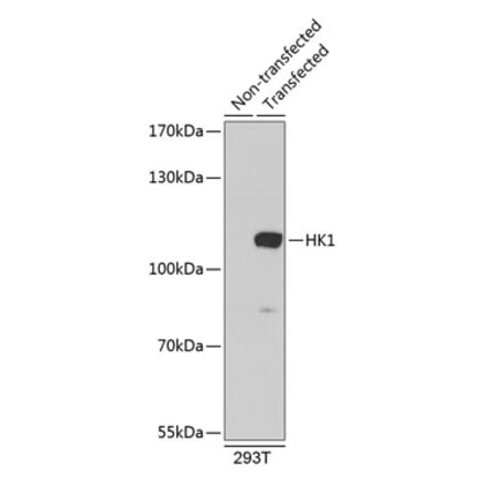 Western Blot - Anti-Hexokinase 1 Antibody (A8428) - Antibodies.com