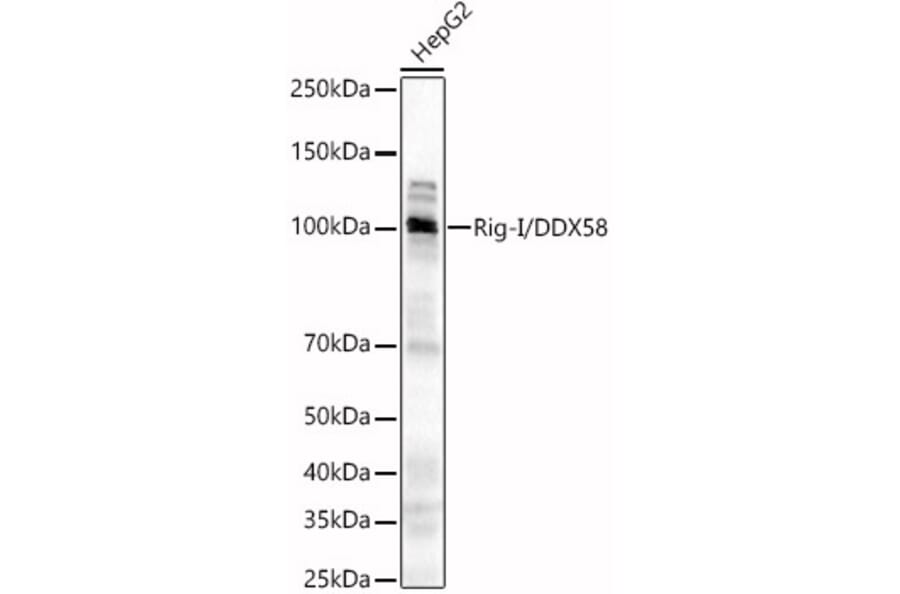 Western Blot - Anti-RIG-I/DDX58 Antibody (A8429) - Antibodies.com