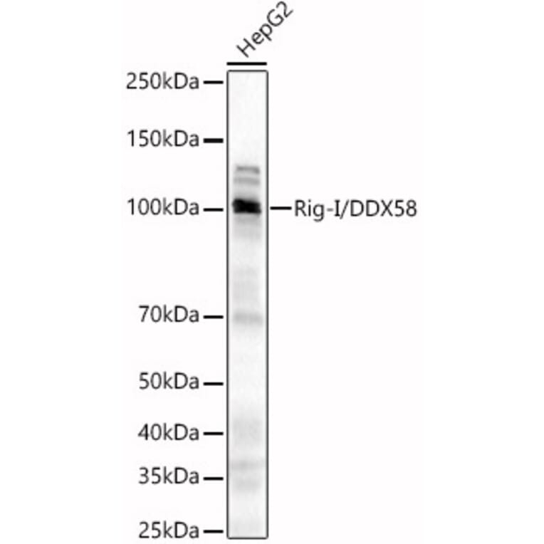 Western Blot - Anti-RIG-I/DDX58 Antibody (A8429) - Antibodies.com