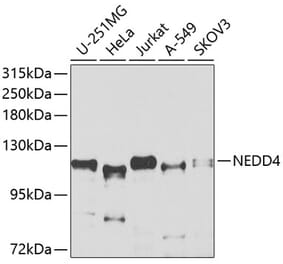 Western Blot - Anti-NEDD4 Antibody (A8430) - Antibodies.com
