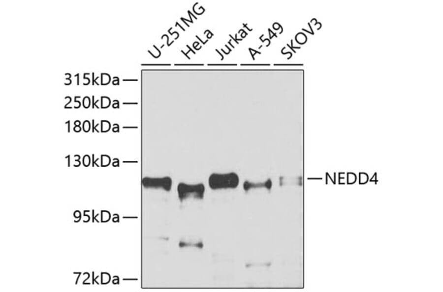 Western Blot - Anti-NEDD4 Antibody (A8430) - Antibodies.com