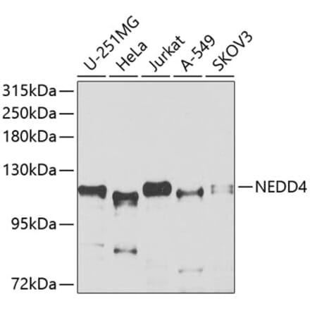 Western Blot - Anti-NEDD4 Antibody (A8430) - Antibodies.com