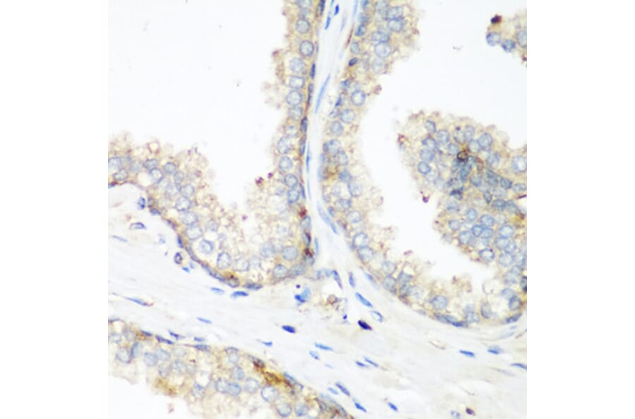 Immunohistochemistry - Anti-NEDD4 Antibody (A8430) - Antibodies.com