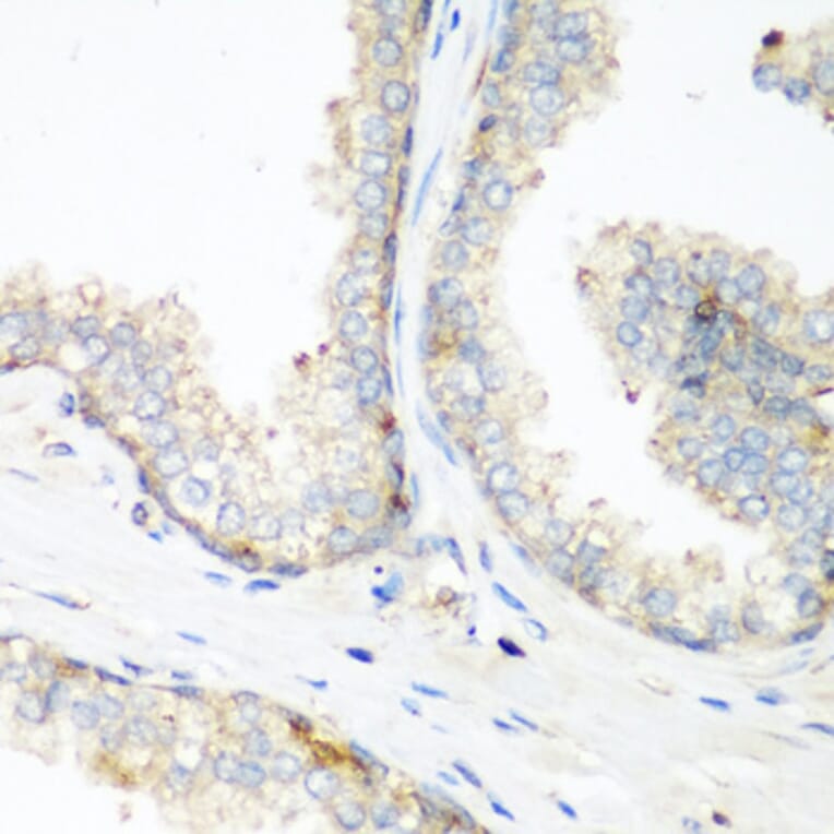 Immunohistochemistry - Anti-NEDD4 Antibody (A8430) - Antibodies.com