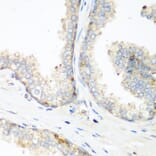 Immunohistochemistry - Anti-NEDD4 Antibody (A8430) - Antibodies.com