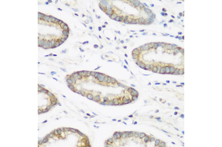 Immunohistochemistry - Anti-NEDD4 Antibody (A8430) - Antibodies.com