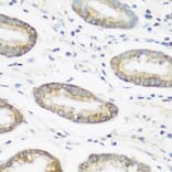 Immunohistochemistry - Anti-NEDD4 Antibody (A8430) - Antibodies.com