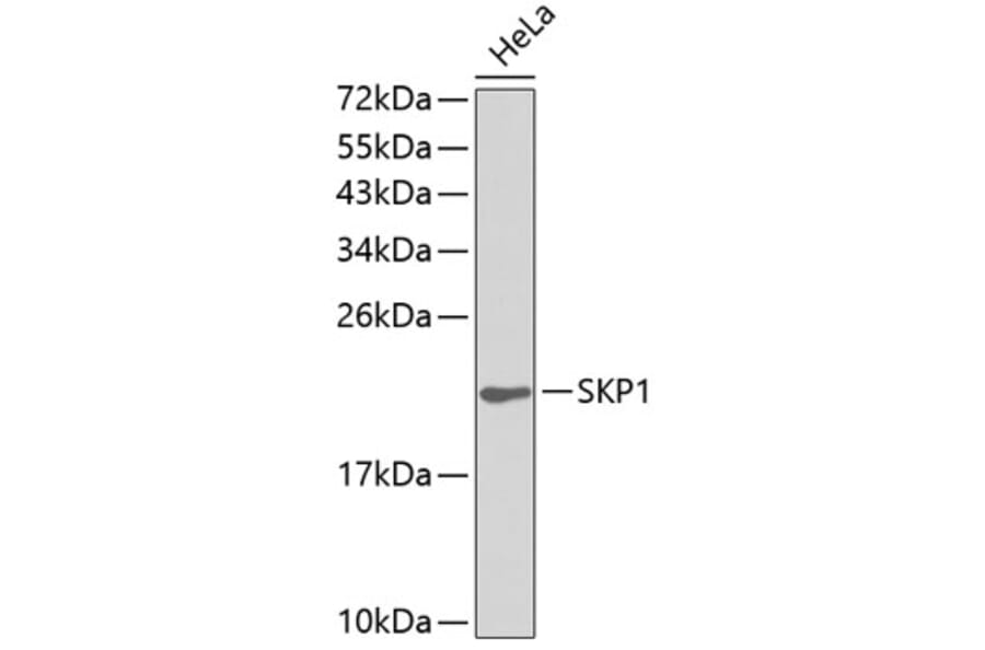 Western Blot - Anti-SKP1 Antibody (A0554) - Antibodies.com