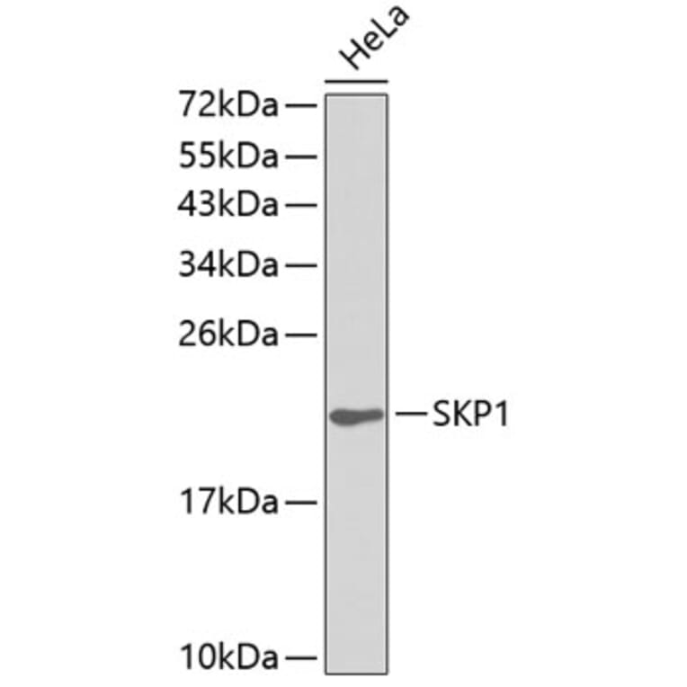 Western Blot - Anti-SKP1 Antibody (A0554) - Antibodies.com