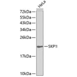 Western Blot - Anti-SKP1 Antibody (A0554) - Antibodies.com