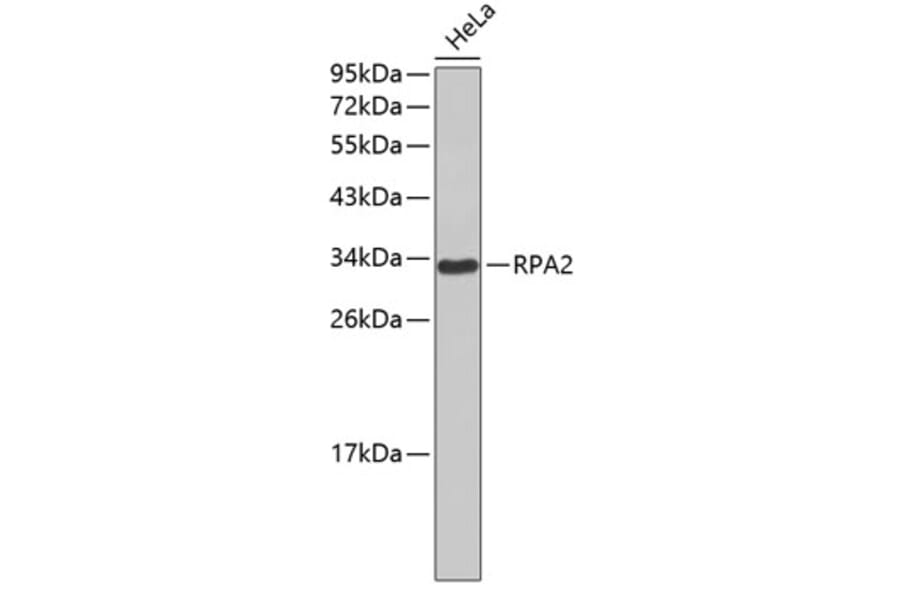 Western Blot - Anti-RPA2 Antibody (A0568) - Antibodies.com