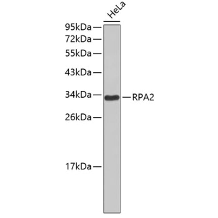 Western Blot - Anti-RPA2 Antibody (A0568) - Antibodies.com