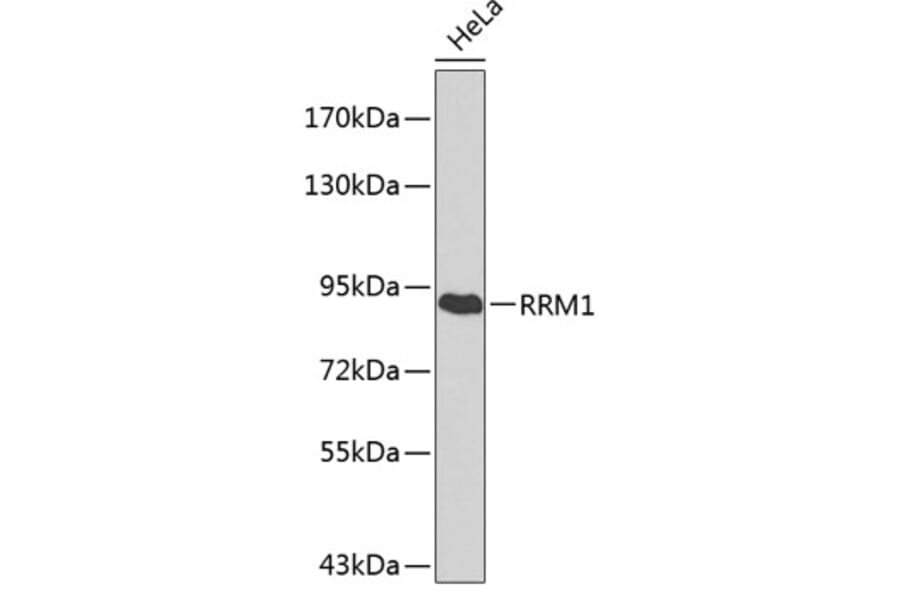 Western Blot - Anti-RRM1 Antibody (A0599) - Antibodies.com