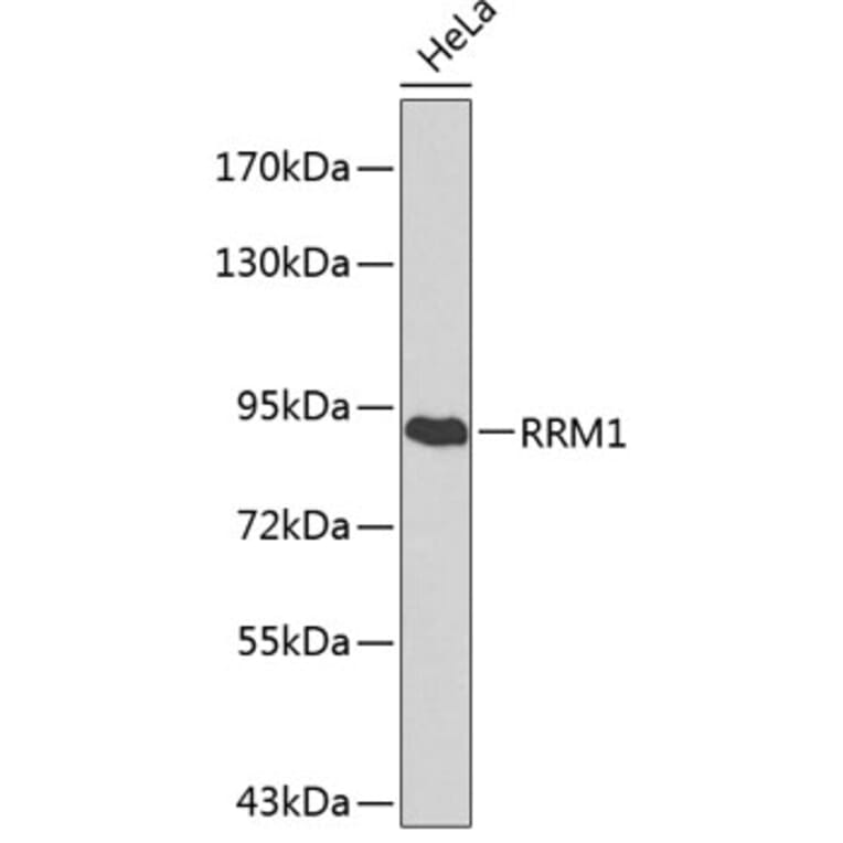 Western Blot - Anti-RRM1 Antibody (A0599) - Antibodies.com