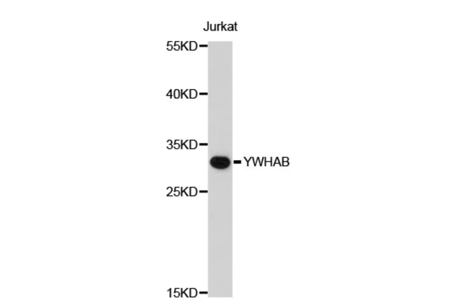 Western Blot - Anti-YWHAB Antibody (A0602) - Antibodies.com