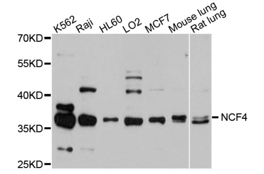 Western Blot - Anti-NCF4 Antibody (A0610) - Antibodies.com