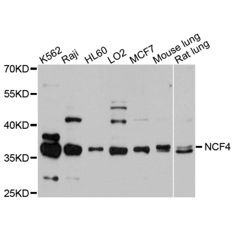 Western Blot - Anti-NCF4 Antibody (A0610) - Antibodies.com