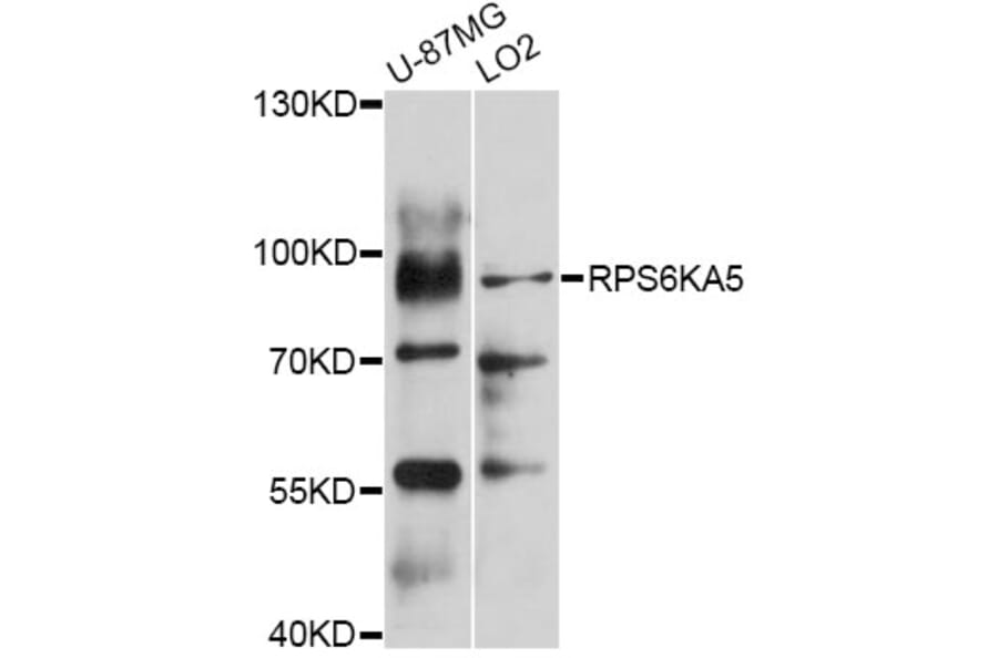 Western Blot - Anti-RPS6KA5 Antibody (A0614) - Antibodies.com