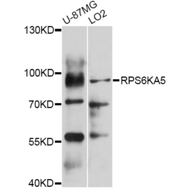 Western Blot - Anti-RPS6KA5 Antibody (A0614) - Antibodies.com