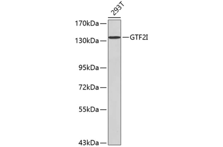 Western Blot - Anti-GTF2I Antibody (A0617) - Antibodies.com