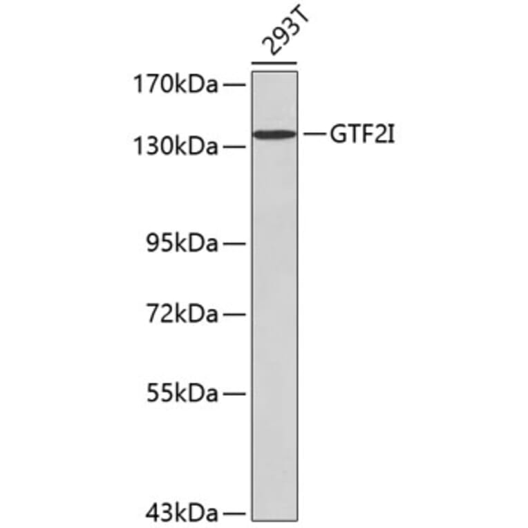 Western Blot - Anti-GTF2I Antibody (A0617) - Antibodies.com