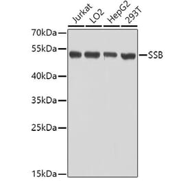 Western Blot - Anti-SSB Antibody (A8443) - Antibodies.com