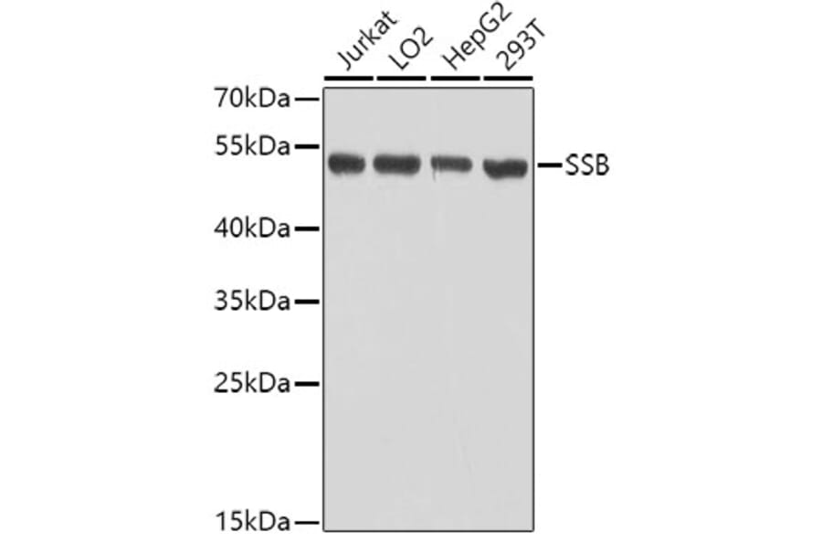 Western Blot - Anti-SSB Antibody (A8443) - Antibodies.com