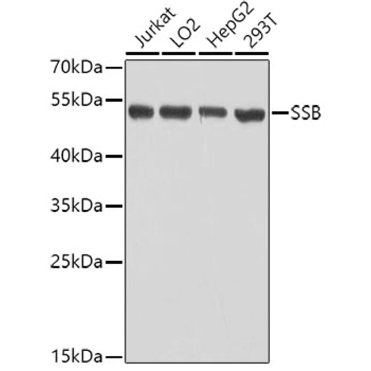 Western Blot - Anti-SSB Antibody (A8443) - Antibodies.com