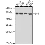 Western Blot - Anti-SSB Antibody (A8443) - Antibodies.com