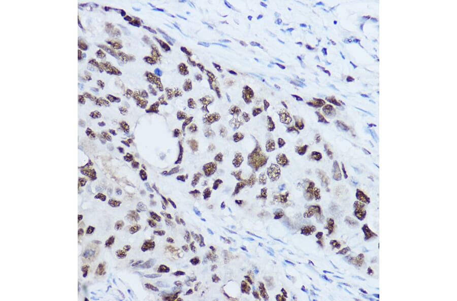 Immunohistochemistry - Anti-SSB Antibody (A8443) - Antibodies.com