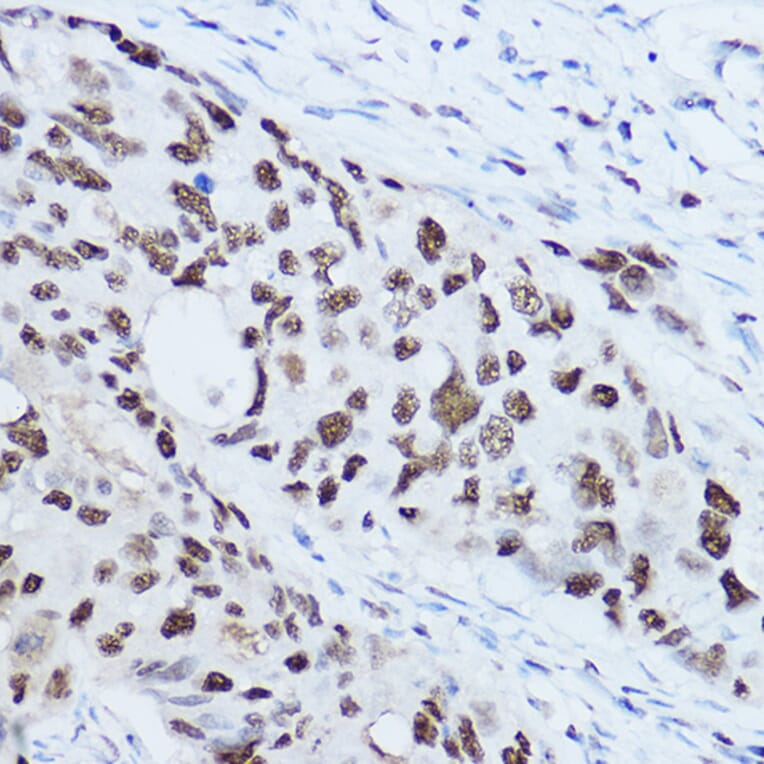 Immunohistochemistry - Anti-SSB Antibody (A8443) - Antibodies.com