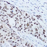 Immunohistochemistry - Anti-SSB Antibody (A8443) - Antibodies.com