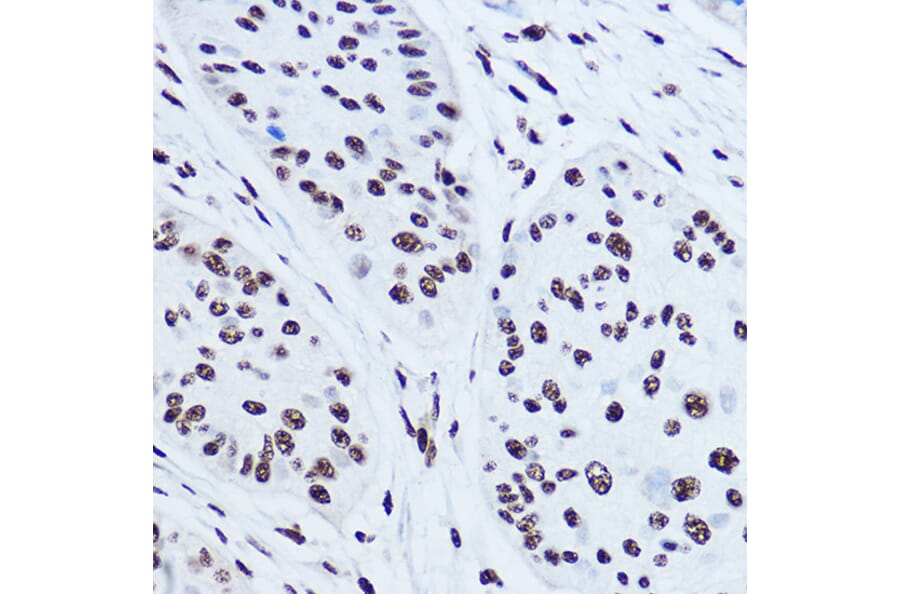 Immunohistochemistry - Anti-SSB Antibody (A8443) - Antibodies.com