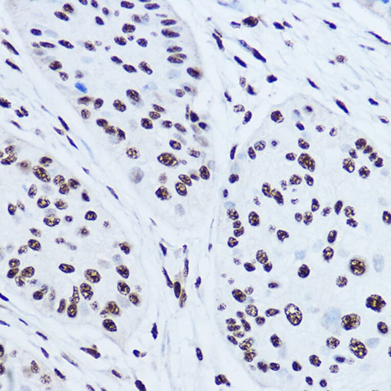 Immunohistochemistry - Anti-SSB Antibody (A8443) - Antibodies.com