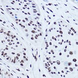 Immunohistochemistry - Anti-SSB Antibody (A8443) - Antibodies.com