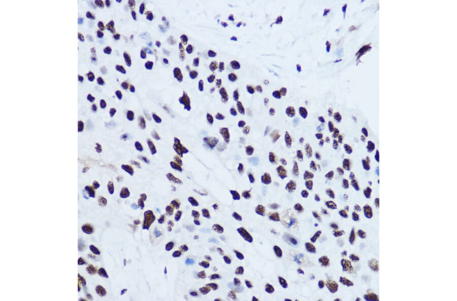 Immunohistochemistry - Anti-SSB Antibody (A8443) - Antibodies.com