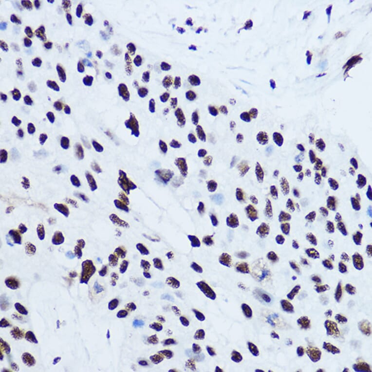 Immunohistochemistry - Anti-SSB Antibody (A8443) - Antibodies.com