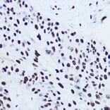 Immunohistochemistry - Anti-SSB Antibody (A8443) - Antibodies.com