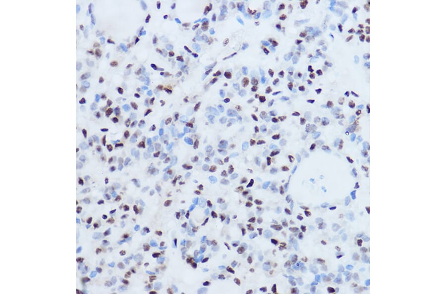 Immunohistochemistry - Anti-SSB Antibody (A8443) - Antibodies.com