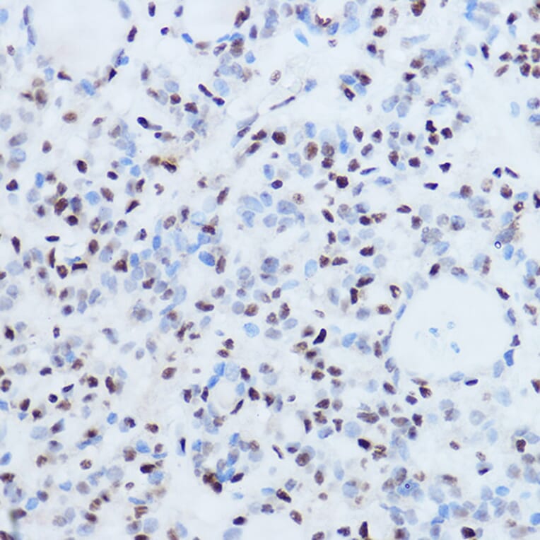 Immunohistochemistry - Anti-SSB Antibody (A8443) - Antibodies.com