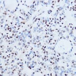 Immunohistochemistry - Anti-SSB Antibody (A8443) - Antibodies.com