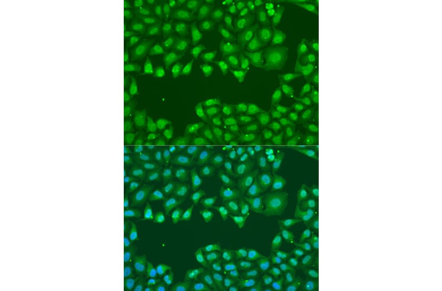 Immunofluorescence - Anti-SSB Antibody (A8443) - Antibodies.com