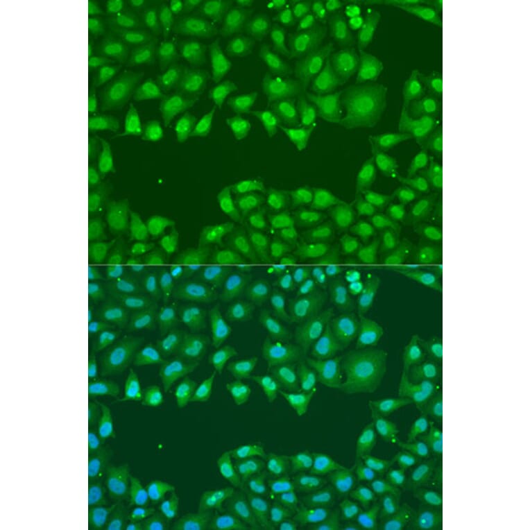 Immunofluorescence - Anti-SSB Antibody (A8443) - Antibodies.com
