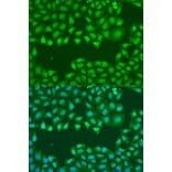 Immunofluorescence - Anti-SSB Antibody (A8443) - Antibodies.com