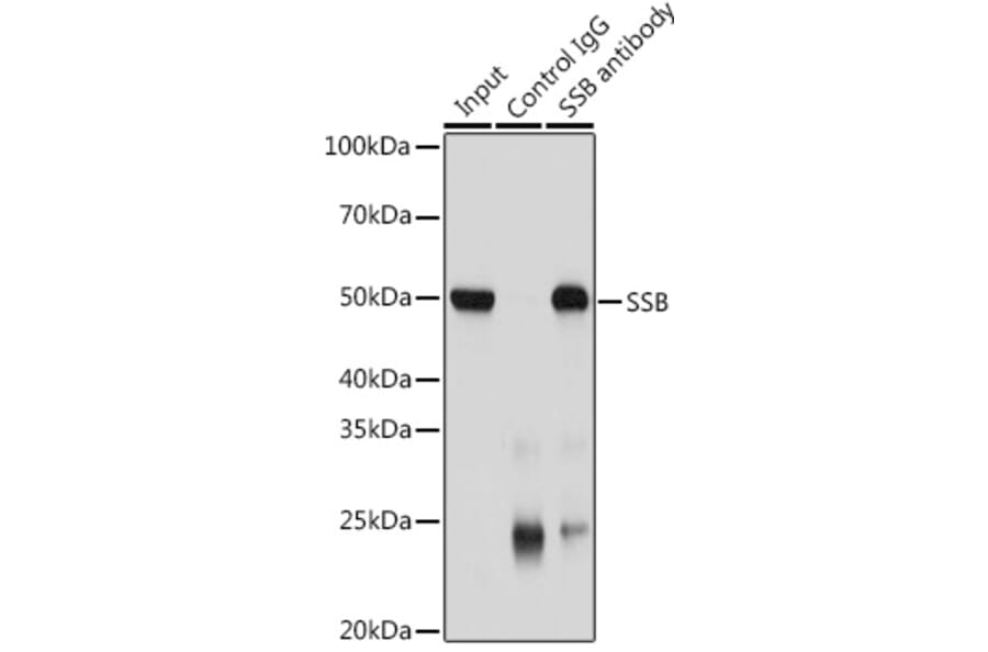 Western Blot - Anti-SSB Antibody (A8443) - Antibodies.com