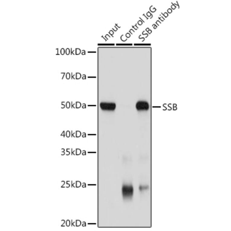 Western Blot - Anti-SSB Antibody (A8443) - Antibodies.com