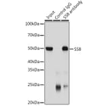 Western Blot - Anti-SSB Antibody (A8443) - Antibodies.com