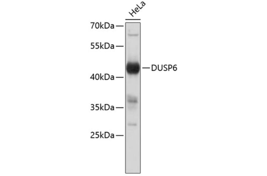 Western Blot - Anti-DUSP6 Antibody (A8444) - Antibodies.com